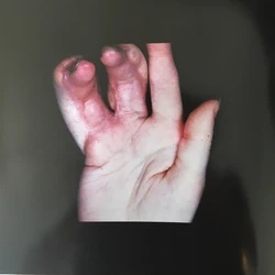 Arca - Xen